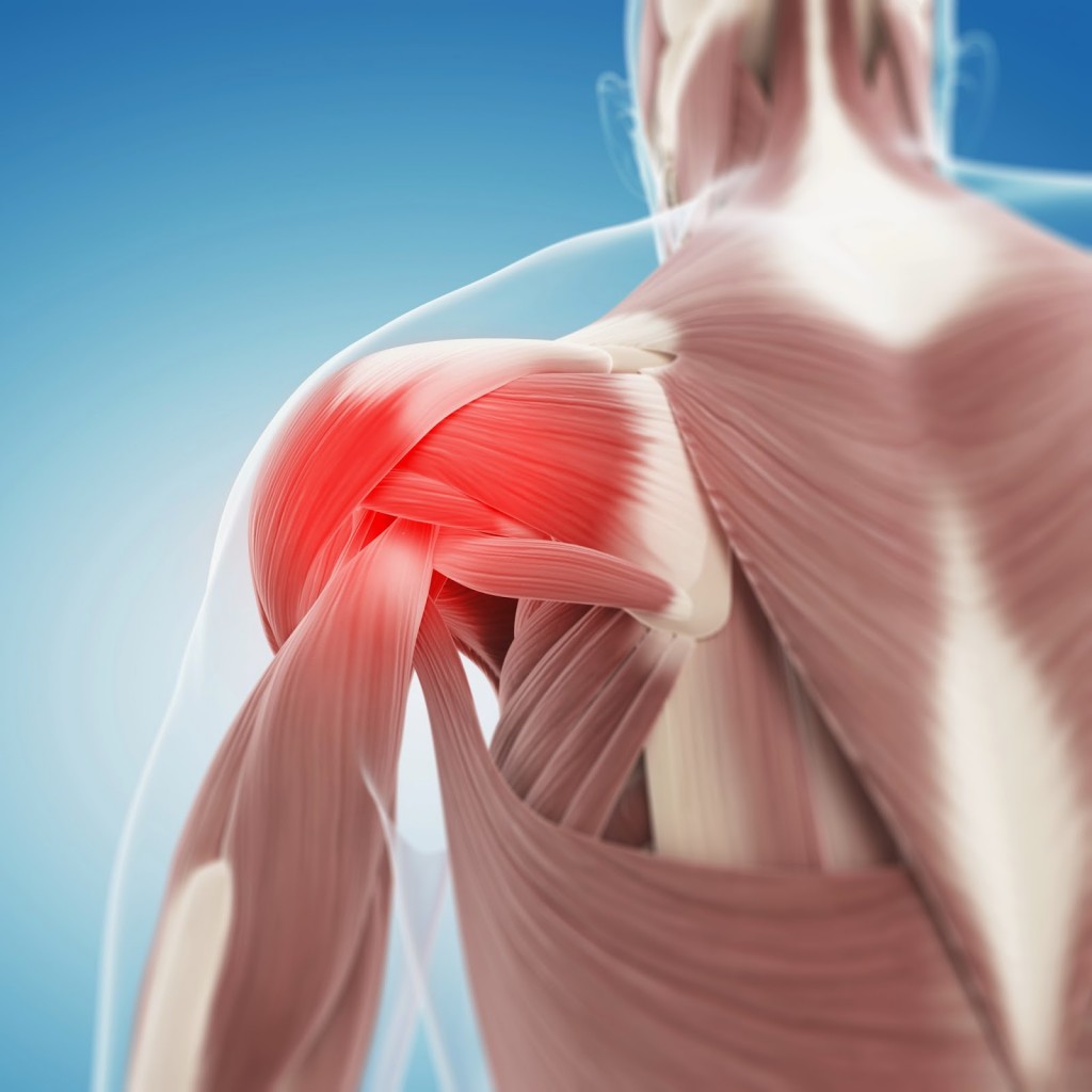 Shoulder-Pain